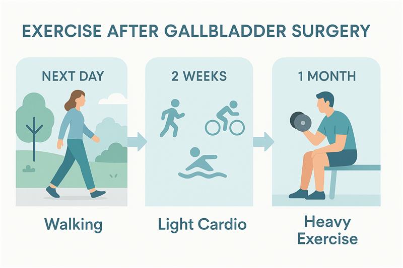 exercise and sports after Gallbladder stone surgery
