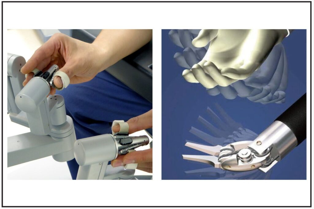 Robotic instruments & surgeons' hands controlling the robotic instruments