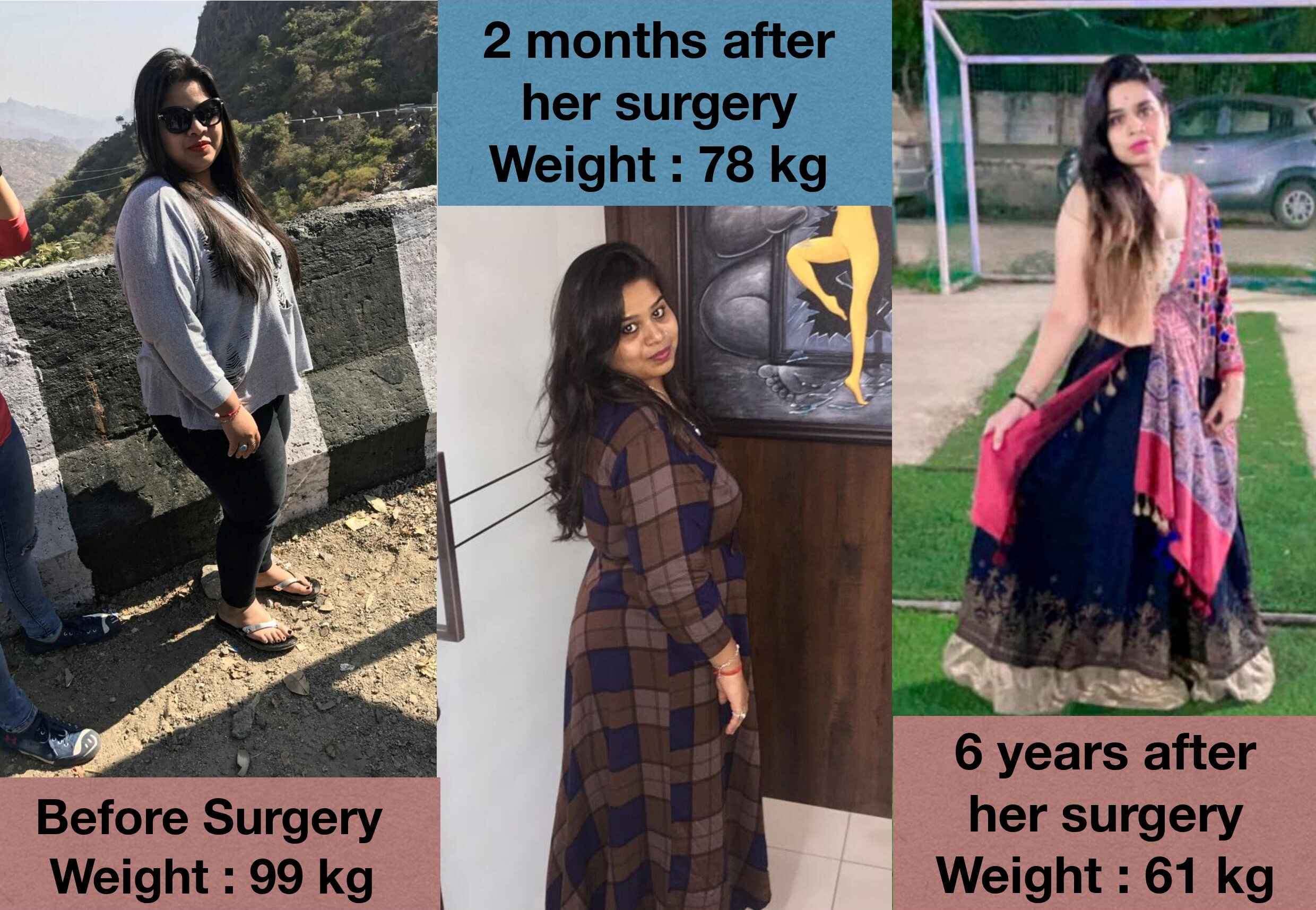 Patient Treated best doctor for obesity surgery in ahmedabad, india