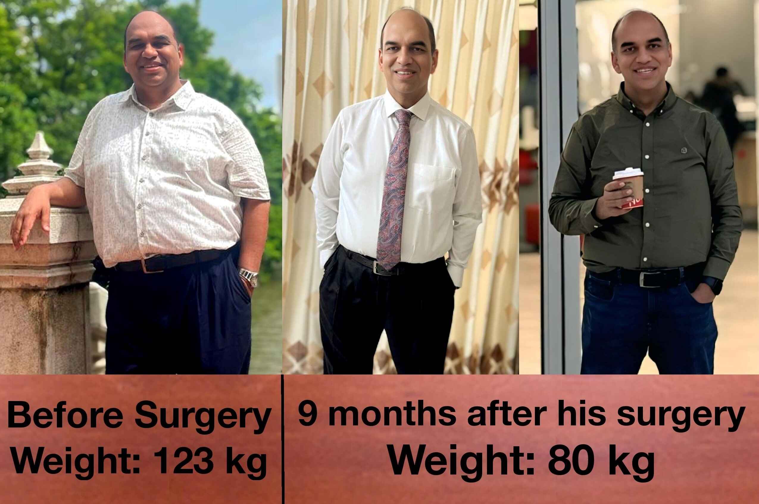 Patient Treated for weight loss surgery ahmedabad, gujarat, india
